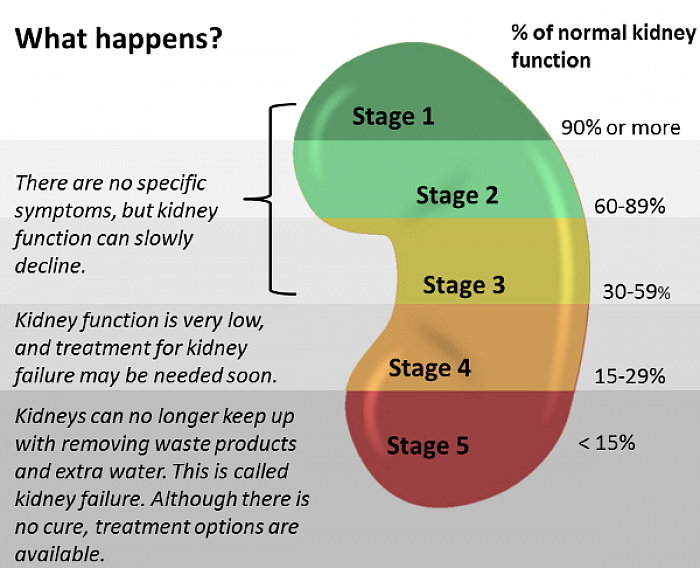 STAGES OF KIDNEY DEASES