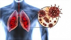 DAMAGED LUNGS.
